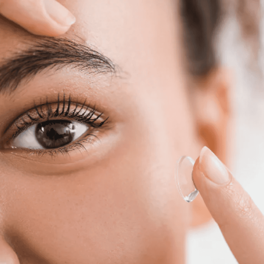 Lentes de Contacto Terapéuticos (1)